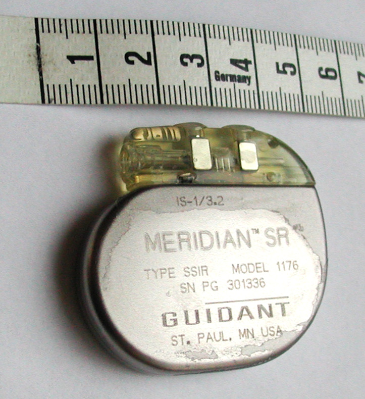 An explanted cardiac pacemaker generator photographed beside a ruler, showing its rounded metal can and the header connector block where the leads attach.